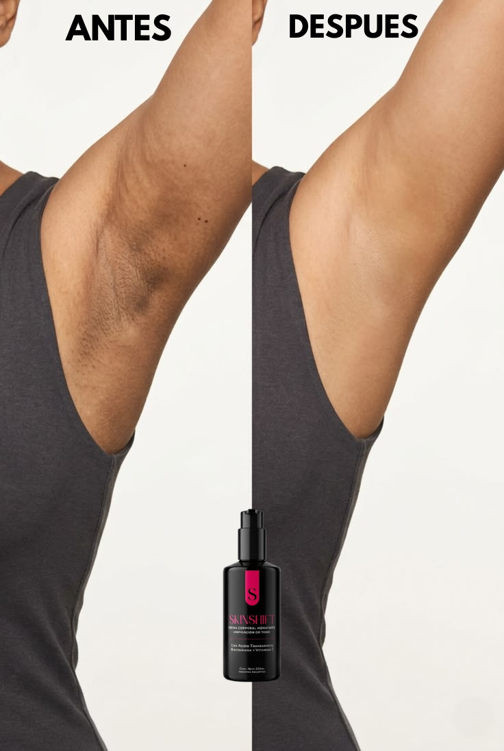 SKINSHIFT® - Recuperá la piel que siempre quisiste mostrar.